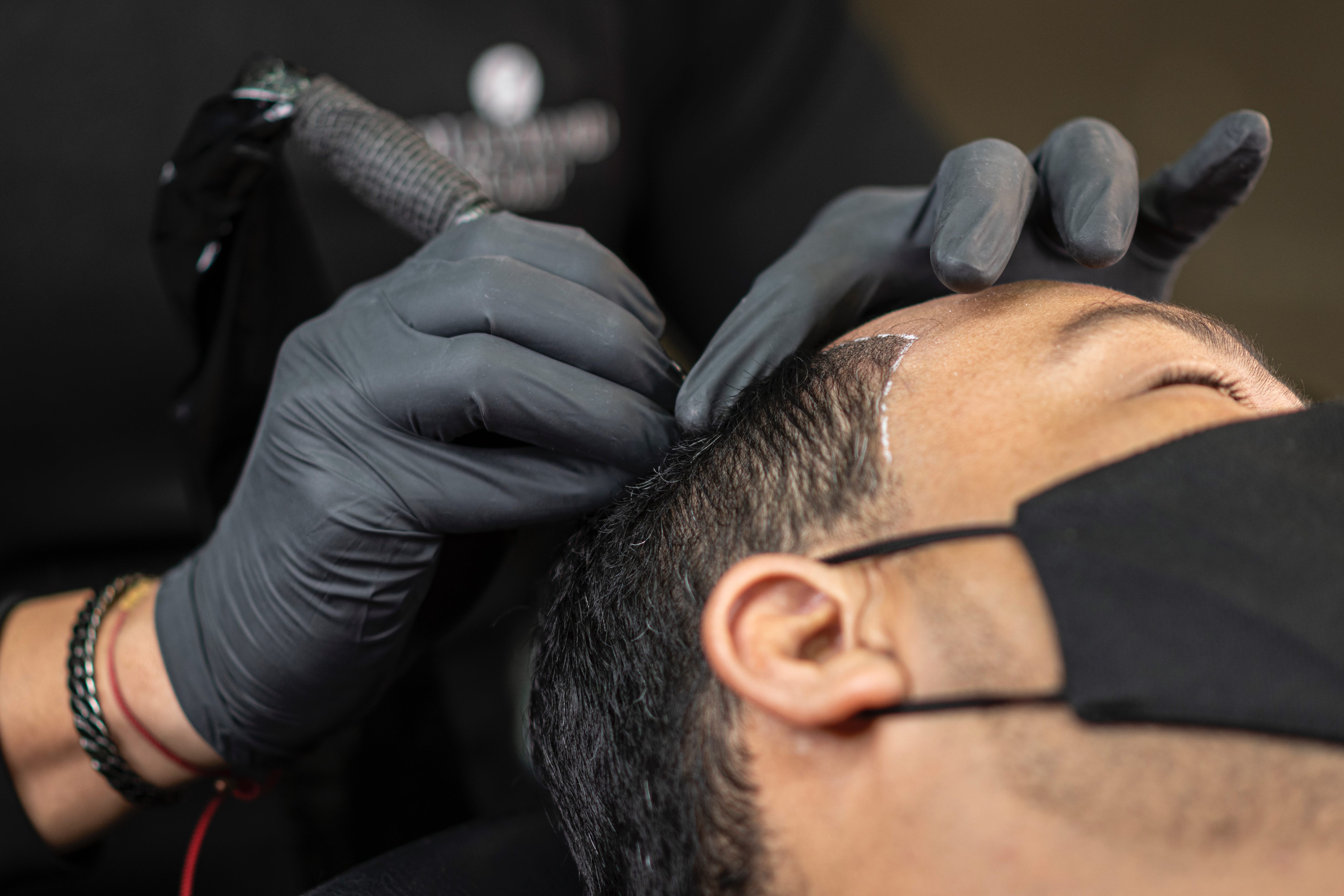 Procedimiento de Micropigmentación Capilar